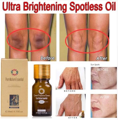 Pure Natural Essential Ultra Brightening Spotless Oil Dark Spots Fade Away Age Spots Hyper Pigmentation Essential Oil.