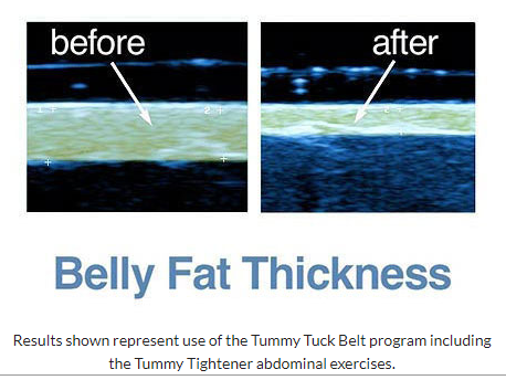 Original Tummy Tuck Belt